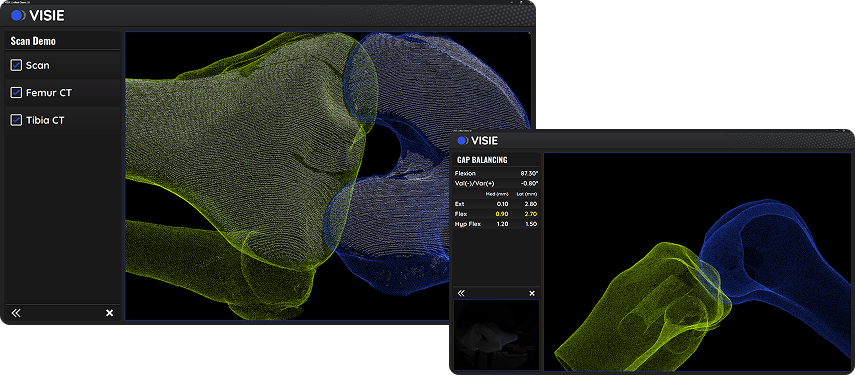 VISIE software demo screens of bones